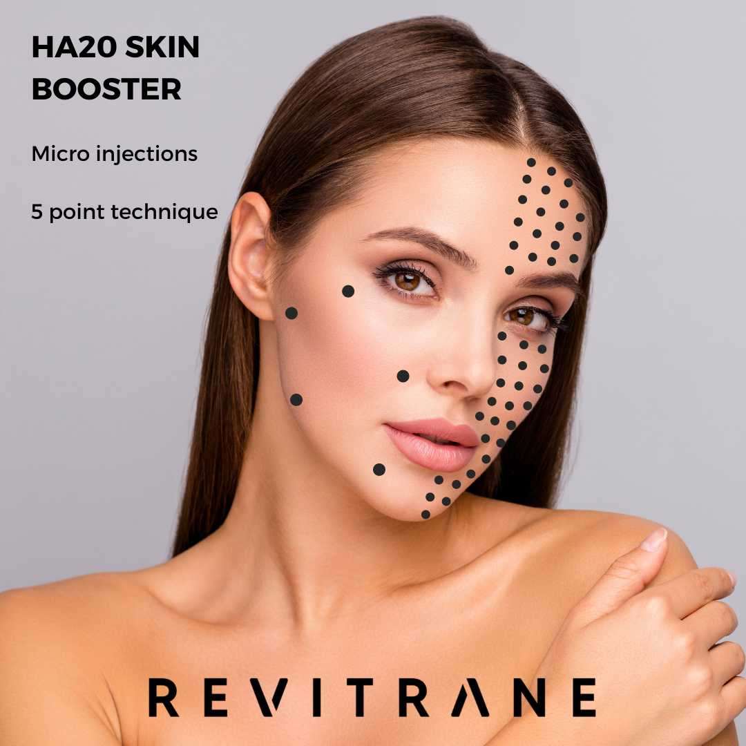 Revitrane HA20 Skin Booster 3x 2ml